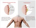 normal-breast-tissue-and-gynecomastia.jpg